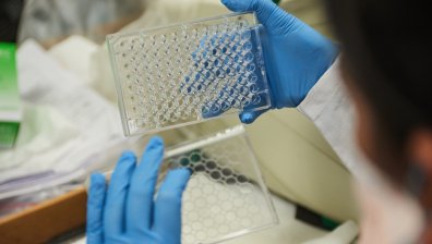 Маймунска шарка: Идва ли нова пандемия и кой попада в рисковата група?