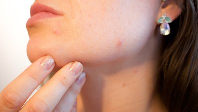 Тези състояния често могат да се объркат с алергия