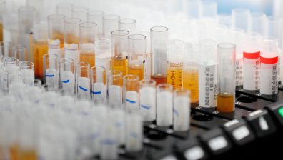 "Астра Зенека" спря разработването на ваксина срещу Ковид-19