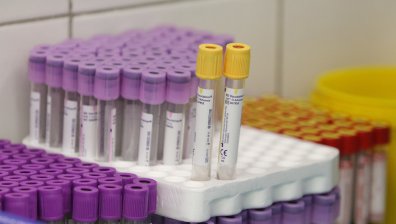 Създадоха микрочип, който открива Ковид-19 преди да се появят симптоми