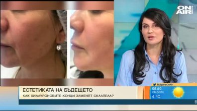 Как хиалуроновите конци заменят скалпела?