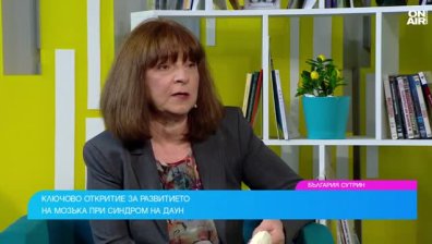 Български учени с откритие за развитието на мозъка при синдром на Даун