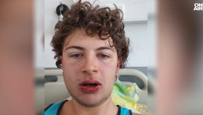 Мъжът, счупил челюстта на младеж край Бургас, е полицай в изпитателен срок