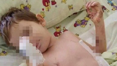 Домът им изгоря: Малкият Унут е с 30% изгаряния, майка му с повече