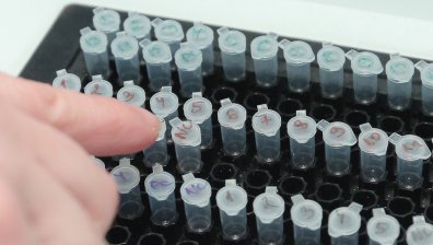 Част от 15-те жертви на Ковид-19 са без придружаващи заболявания