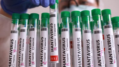 Проф. Радка Аргирова: Хантавирусът не е нечуван, нито място за страх