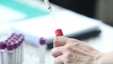 Повече излекувани от новозаразени с Ковид-19, 55 души са починали (Обновена)