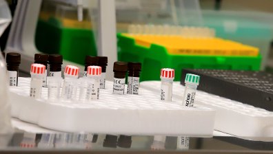 Защо е важно да се направи PCR тест преди ваксинация срещу Ковид-19?