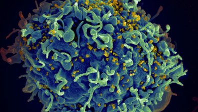 Лекари излекуваха бебе, родено с HIV