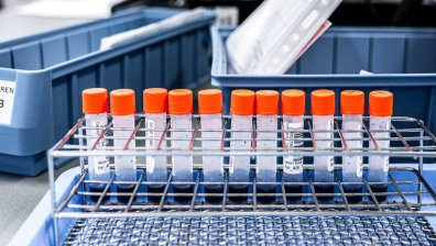 Повече от 2000 души са изследвани в Банско, над 5% са с антитела