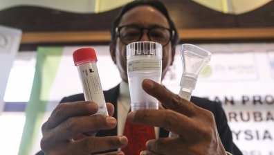 В САЩ одобриха първи по рода си кръвен тест за Ковид-19