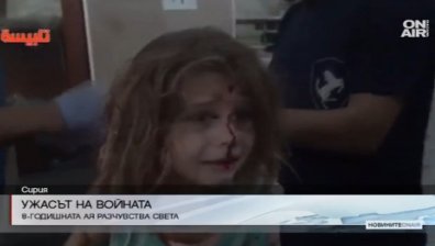 Ранено 8-годишно сирийче стана символ на грозното лице на войната
