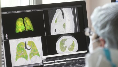 Имунолог каза колко трае имунитетът след преболедуване и ваксиниране