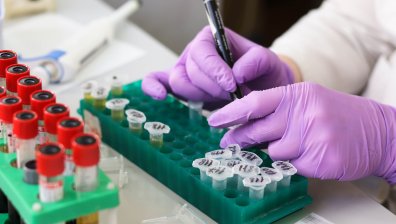 Японски учени започнаха клинични тестове за лечение на рак със стволови клетки