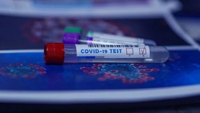 174 са новите случаи на Ковид-19 у нас,  8 души са починали