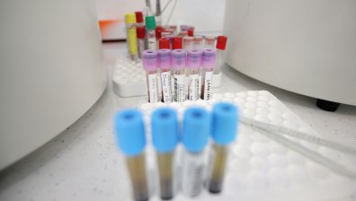 29 починали и 1472 заразени при 8738 PCR теста