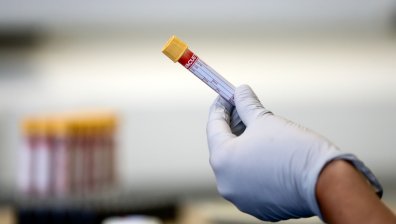 232-ма новозаразени с Ковид-19 при 5393 теста, шестима са починали