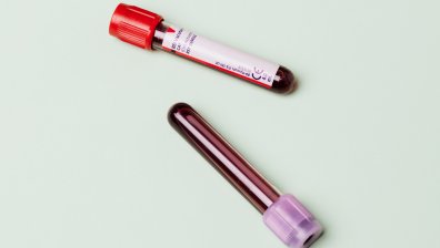 Поставят оздравелите от Дома за възрастни в Русе под карантина