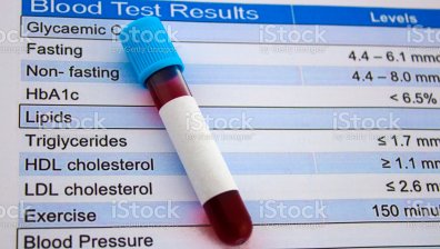 7 начина да поддържате здравословни нива на холестерол