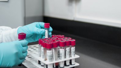 Египет предприема стъпки за внос на суровини за лекарства срещу маймунска шарка