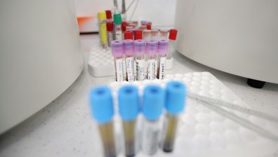 Скок на новозаразените, трима души загубиха битката с Ковид-19