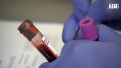 ХИВ може и да се лекува: Втори пациент е в ремисия
