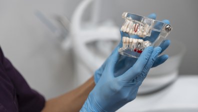 Съвременни зъбни импланти: Какво да очаквате преди, по време и след поставянето?