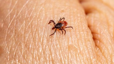 Първи случай на марсилска треска в Монтанско, 71-годишна жена е в болница