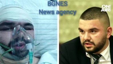 Пребитият 23-годишен българин в Охрид е със спукани прешлени, ребра и счупена челюст