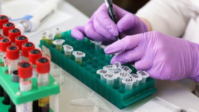 СЗО: Малко вероятно е епидемията от маймунска шарка да се превърне в пандемия