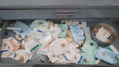 Извадиха сачми от носа на дете, престояли в него цели 2 години