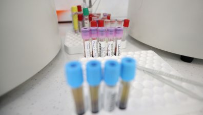 Кметът на Доспат: 30 са новозаразени, не е фарс и не е умишлено