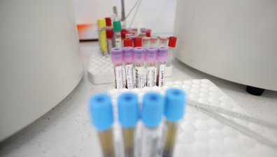 Расте броят на заразените и хоспитализираните, вирусът взе 58 жертви за 24 часа