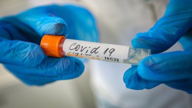 9 починали с Ковид-19 за ден и 376 новозаразени за денонощието