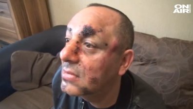 Тираджии пребиха мъж от Видин, карал твърде бавно