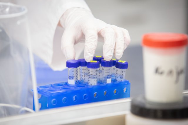 Новите случаи на к Ковид 19 у нас са 254 при направени