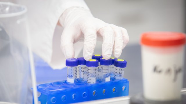 Новите потвърдени случаи на Kовид 19 у нас за последното денонощие са