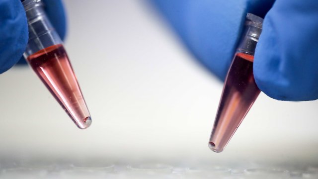 Световната здравна организация разследва дали вирусът на маймунска шарка присъства