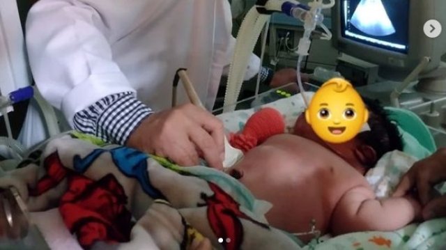 Бебе гигант се роди в в болница в Бразилия Момчето