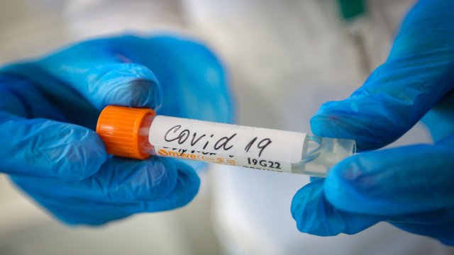 156 са новите случаи на зараза с Ковид 19 за последното