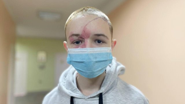 13 годишно момче по чудо е извадено живо под развалините на