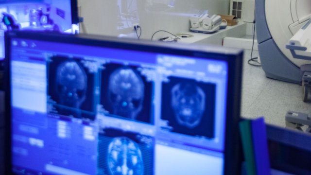 Детето което е прието в кома в болница в Пловдив