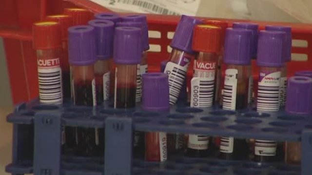 През 2020 г са диагностицирани 185 души с ХИВ у