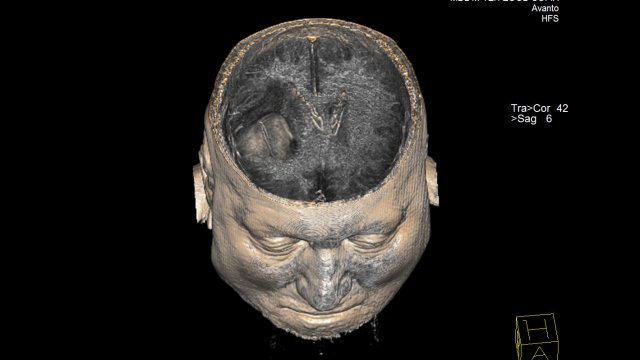 Дълго време неандерталците са били представяни като нашите малоумни груби