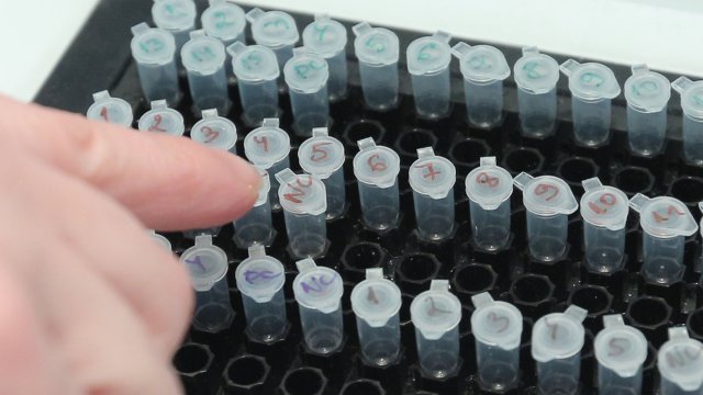 Малко под 400 нови случая на коронавирус са били регистрирани