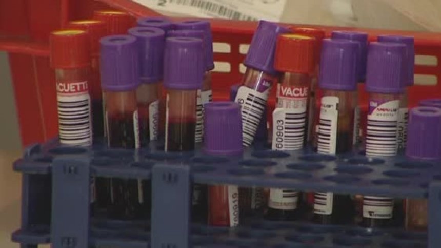 Обрат в лечението на Ковид-19, СЗО не препоръчва кръвната плазма