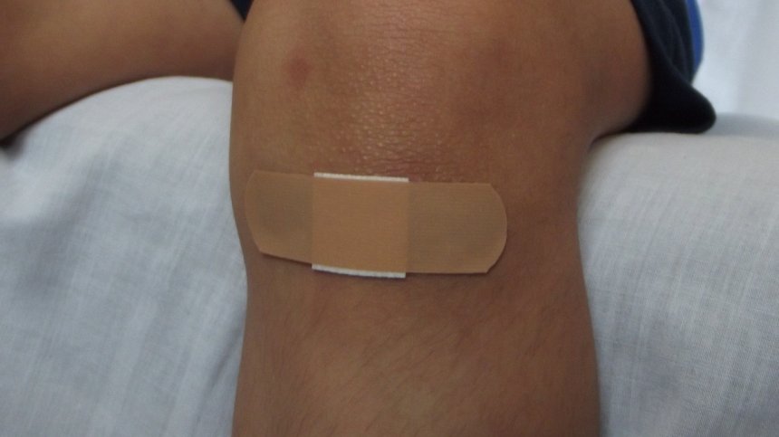 Как да третираме детските рани при охлузване?