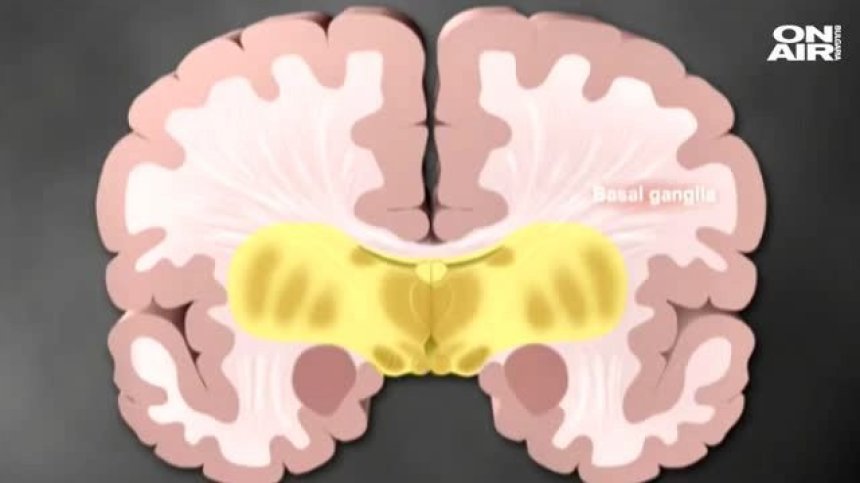 Безплатни консултации за пациенти с Паркинсон у нас