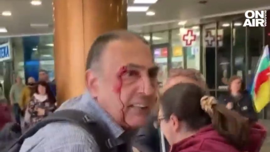 Кървав бой между демонстранти "за" и "против" военна помощ за Украйна (+ВИДЕО)