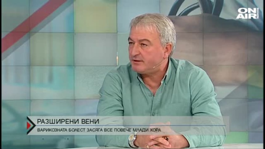 Разширените вени все по-често засягат и млади хора